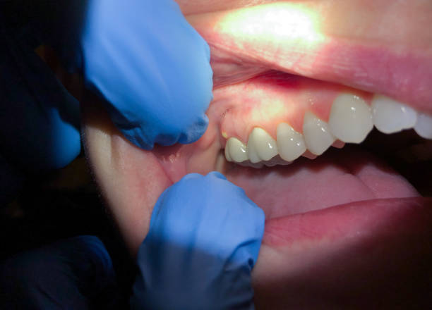 Best Emergency Dental Services for Seniors in Trezevant, TN